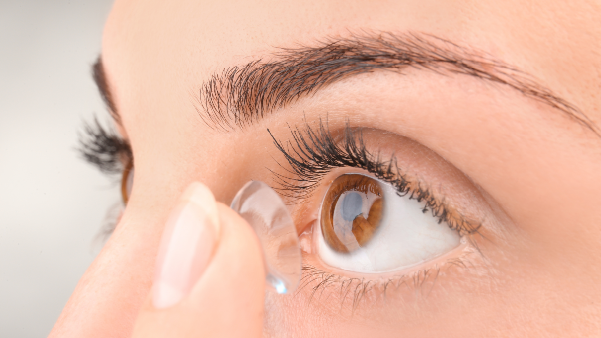 Control de miopía con lentes de contacto